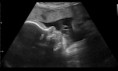 /album/fotogalerij/a28w5d-jpg/